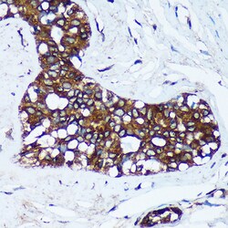 Invitrogen RM30 Polyclonal Antibody 100 &mu;L | Buy Online | Invitrogen&trade; | Fisher Scientific