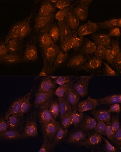 Invitrogen ACBD3 Polyclonal Antibody 100 &mu;L; Unconjugated:Antibodies,