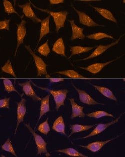 Invitrogen ACBD3 Polyclonal Antibody 100 &mu;L; Unconjugated:Antibodies,