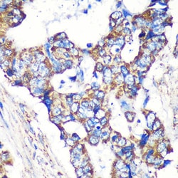 Invitrogen STARD3NL Polyclonal Antibody 100 &mu;L | Buy Online | Invitrogen&trade; | Fisher Scientific