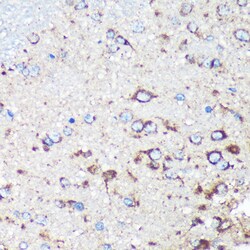 Invitrogen STARD3NL Polyclonal Antibody 100 &mu;L | Buy Online | Invitrogen&trade; | Fisher Scientific
