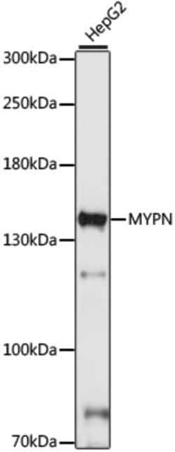 Invitrogen MYPN Polyclonal Antibody 100 &mu;L; Unconjugated:Antibodies,