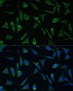Invitrogen LSM14A Polyclonal Antibody 100 &mu;L | Buy Online | Invitrogen&trade; | Fisher Scientific