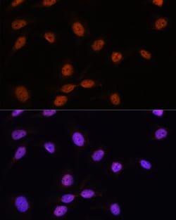 Invitrogen SRSF7 Polyclonal Antibody 100 &mu;L; Unconjugated:Antibodies,