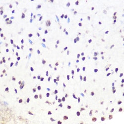 Invitrogen SRSF7 Polyclonal Antibody 100 &mu;L; Unconjugated:Antibodies,