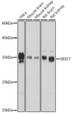 Invitrogen SRSF7 Polyclonal Antibody 100 &mu;L; Unconjugated:Antibodies,