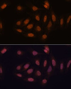 Invitrogen SNIP1 Polyclonal Antibody 100 &mu;L; Unconjugated:Antibodies,