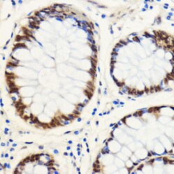 Invitrogen SNIP1 Polyclonal Antibody 100 &mu;L; Unconjugated:Antibodies,