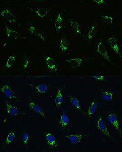Invitrogen ATP5I Polyclonal Antibody 100 μL; Unconjugated:Antibodies,