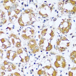 Invitrogen ATP5I Polyclonal Antibody 100 μL; Unconjugated:Antibodies,