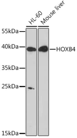 Invitrogen HOXB4 Polyclonal Antibody 100 &mu;L | Buy Online | Invitrogen&trade; | Fisher Scientific