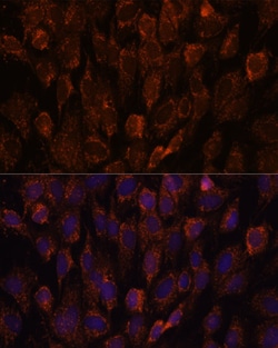 Invitrogen NSDHL Polyclonal Antibody 100 μL; Unconjugated:Antibodies,