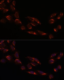 Invitrogen NSDHL Polyclonal Antibody 100 μL; Unconjugated:Antibodies,