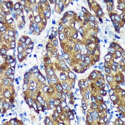 Invitrogen NSDHL Polyclonal Antibody 100 μL; Unconjugated:Antibodies,