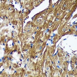 Invitrogen NSDHL Polyclonal Antibody 100 μL; Unconjugated:Antibodies,