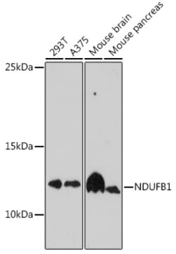 Invitrogen NDUFB1 Polyclonal Antibody 100 &mu;L | Buy Online | Invitrogen&trade; | Fisher Scientific