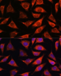 Invitrogen&trade;&nbsp;TMX2 Polyclonal Antibody