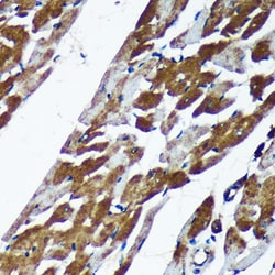 Invitrogen TMX2 Polyclonal Antibody 100 &mu;L | Buy Online | Invitrogen&trade; | Fisher Scientific