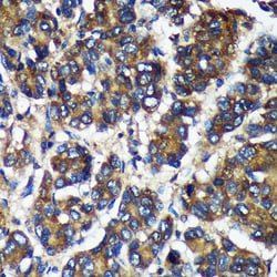 Invitrogen TMX2 Polyclonal Antibody 100 &mu;L | Buy Online | Invitrogen&trade; | Fisher Scientific