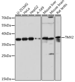 Invitrogen TMX2 Polyclonal Antibody 100 &mu;L | Buy Online | Invitrogen&trade; | Fisher Scientific