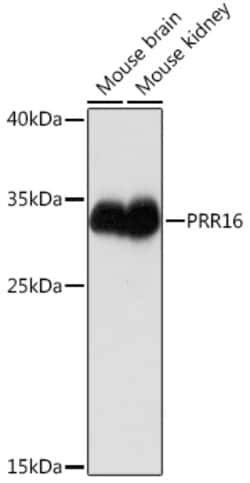 Invitrogen PRR16 Polyclonal Antibody 100 &mu;L; Unconjugated:Antibodies,