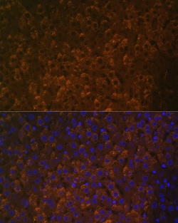 Invitrogen UGT1A6 Polyclonal Antibody 100 &mu;L; Unconjugated:Antibodies,