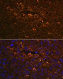 Invitrogen UGT1A6 Polyclonal Antibody 100 &mu;L; Unconjugated:Antibodies,
