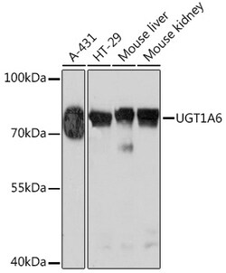 Invitrogen UGT1A6 Polyclonal Antibody 100 &mu;L; Unconjugated:Antibodies,