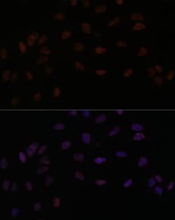 Invitrogen SMEK2 Polyclonal Antibody 100 &mu;L | Buy Online | Invitrogen&trade; | Fisher Scientific
