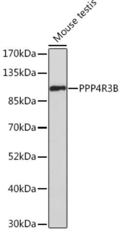 Invitrogen SMEK2 Polyclonal Antibody 100 &mu;L | Buy Online | Invitrogen&trade; | Fisher Scientific