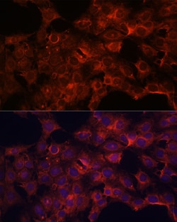 Invitrogen PDP2 Polyclonal Antibody 100 &mu;L; Unconjugated:Antibodies,