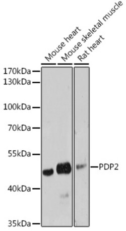 Invitrogen PDP2 Polyclonal Antibody 100 &mu;L; Unconjugated:Antibodies,