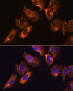 Invitrogen CaMKV Polyclonal Antibody 100 &mu;L; Unconjugated:Antibodies,