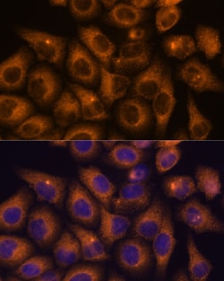 Invitrogen CaMKV Polyclonal Antibody 100 &mu;L; Unconjugated:Antibodies,