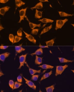 Invitrogen CaMKV Polyclonal Antibody 100 &mu;L; Unconjugated:Antibodies,