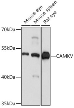 Invitrogen CaMKV Polyclonal Antibody 100 &mu;L; Unconjugated:Antibodies,