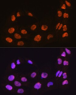 Invitrogen MAML2 Polyclonal Antibody 100 &mu;L; Unconjugated:Antibodies,