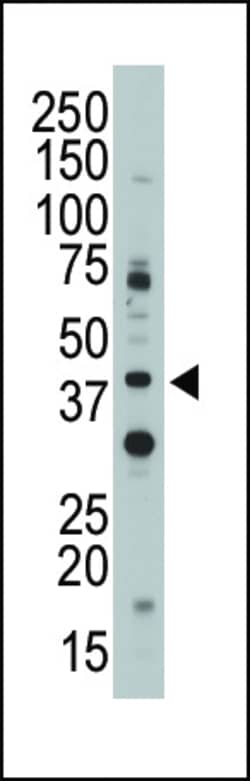 Invitrogen CD33 Polyclonal Antibody 400 μL; Unconjugated:Antibodies,