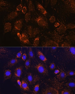 Invitrogen PDE12 Polyclonal Antibody 100 &mu;L; Unconjugated:Antibodies,