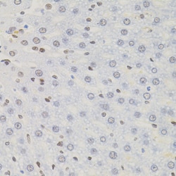 Invitrogen AKAP8 Polyclonal Antibody 100 &mu;L | Buy Online | Invitrogen&trade; | Fisher Scientific