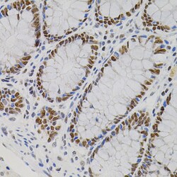 Invitrogen AKAP8 Polyclonal Antibody 100 &mu;L | Buy Online | Invitrogen&trade; | Fisher Scientific