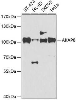 Invitrogen AKAP8 Polyclonal Antibody 100 &mu;L | Buy Online | Invitrogen&trade; | Fisher Scientific