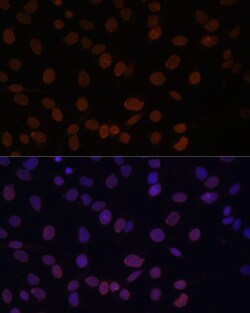 Invitrogen Lamin A/C Polyclonal Antibody 100 &mu;L; Unconjugated:Antibodies,