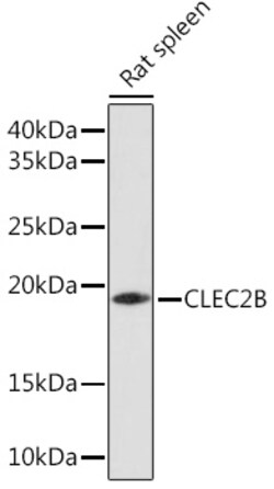 Invitrogen CLEC2B Polyclonal Antibody 100 &mu;L; Unconjugated:Antibodies,