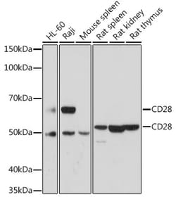 Invitrogen CD28 Polyclonal Antibody 100 &mu;L; Unconjugated:Antibodies,
