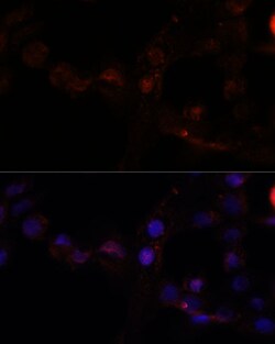 Calpain 7 Polyclonal Antibody:Antibodies, Polyclonal