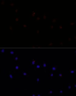Calpain 7 Polyclonal Antibody:Antibodies, Polyclonal