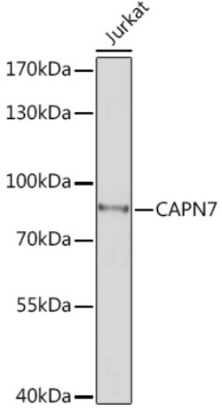 Calpain 7 Polyclonal Antibody:Antibodies, Polyclonal