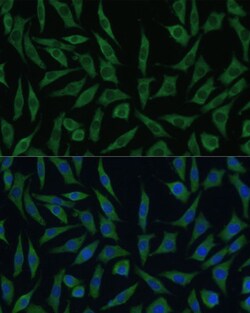 Invitrogen SUMF2 Polyclonal Antibody 100 &mu;L; Unconjugated:Antibodies,