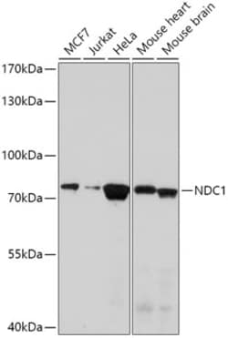 Invitrogen TMEM48 Polyclonal Antibody 100 &mu;L | Buy Online | Invitrogen&trade; | Fisher Scientific